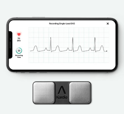 AliveCor KardiaMobile ECG 1 Lead